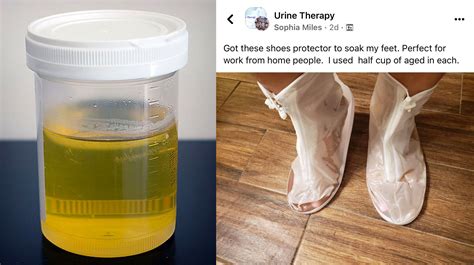 urine therapy for eyes